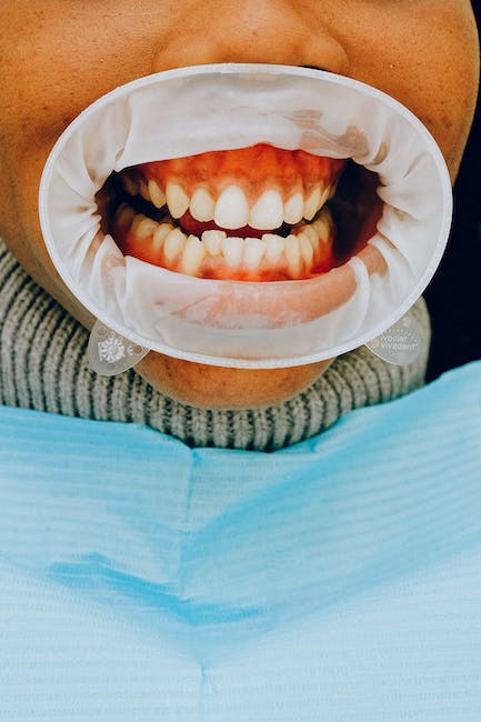 Exploring Bend’s Options for Locking Jaw Treatment: Beyond the Basics
